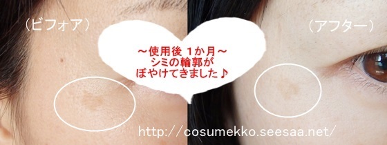 シミウス 口コミ.jpg